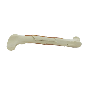 FEMUR ESPONJOSO COM FRATURAS MULTIPLAS ESQUERDO RADIOPACO - CÃO GRANDE - cód. 12719