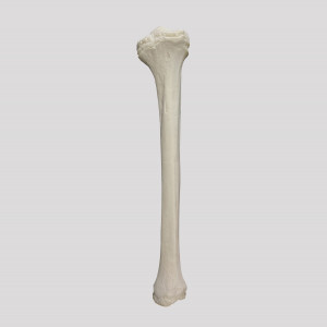 TIBIA RADIOPACA DIREITA INFANTO JUVENIL - cód. 12374