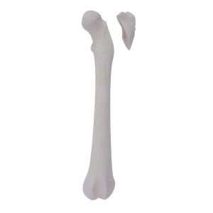 FEMUR ESPONJOSO COM FRATURA PROXIMAL RADIOPACO - ESQUERDO - CÃO GRANDE - cód. 12715