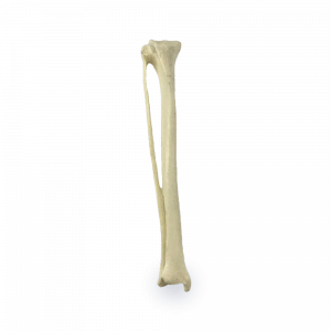 TIBIA DIREITA - CÃO MEDIO - cód. 11669
