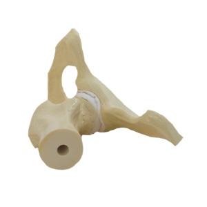 QUADRIL COM OSTEOARTRITE AVANÇADO - cód. 9598-4