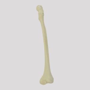 FEMUR RADIOPACO DIREITO INFANTIL COM CANAL E DEFORMIDADE ANTEVERSÃO - cód. 12413