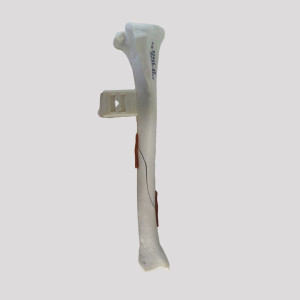 TIBIA ESPONJOSA COM BLOCO E FRATURA OBLIQUA RADIOPACO - DIREITA - CÃO GRANDE - cód. 12721