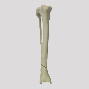 TIBIA ESPONJOSA COM FRATURA OBLIQUA DISTAL RADIOPACO - DIREITA - CÃO GRANDE - cód. 12728
