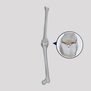 JOELHO DIREITO RADIOPACO  E SIMULAÇAO DE LIGAMENTOS - cód. 12378