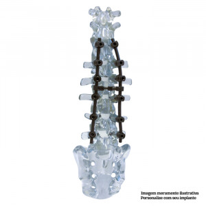 COLUNA LOMBO-SACRA + VERTEBRAS T10, T11 E T12 EM ACRILICO TRABALHADO - cód. 5013AI-OUT