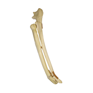 ANTEBRAÇO ESQUERDO CÃO COM FRATURA OLECRANO E TRANSVERSA DISTAL RADIOPACO - CÃO GRANDE - cód. 12557